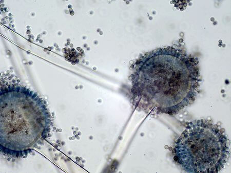 A microscopic view of Aspergillus spp.