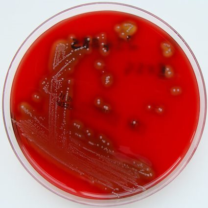 Streptococcus pyogenes growing on a blood agar plate.