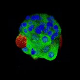 A 3D model of a heterogeneous breast tumor