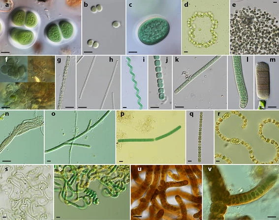 Morphological diversity in cyanobacteria.