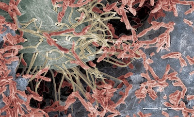 Scanning electron microscopy image of Rhodopseudomonas palustris bacterium (red) colonizing the surface of electrically conductive graphene coated carbon foam.