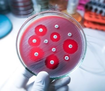 Agar plate covered in bacteria and circles where some bacteria have died