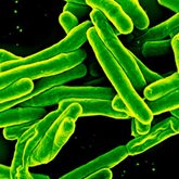 Microscopic view of Mycobacterium tuberculosis.