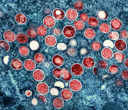 Colorized transmission electron micrograph of mpox particles (red) found within an infected cell (blue), cultured in the laboratory.