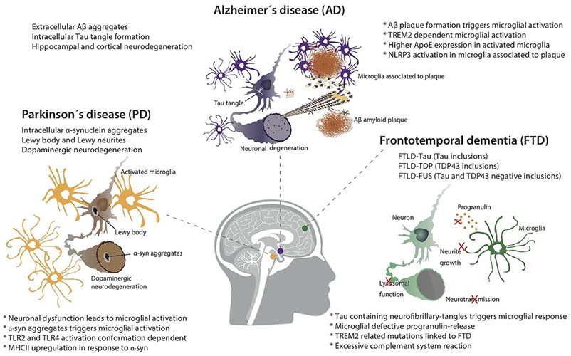 Basic pathology of some forms of neurodegenerative disease.