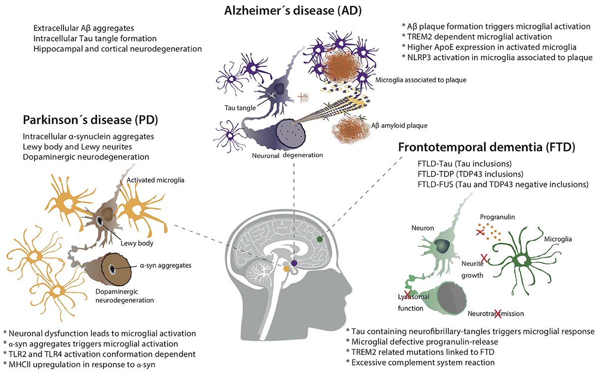 Basic pathology of some forms of neurodegenerative disease.