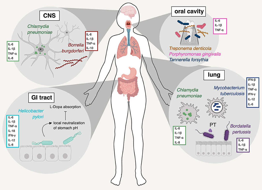 Different bacterial species that have been implicated in neuroinflammation.