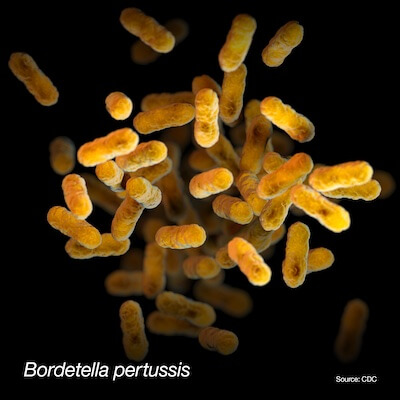 3D rendering of Bordetella pertussis, the causative agent of whooping cough.