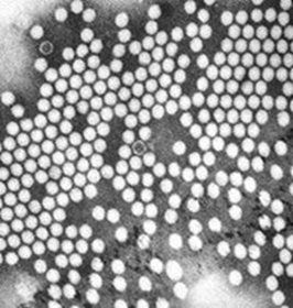 Transmission electron microscope image of poliovirus particles.