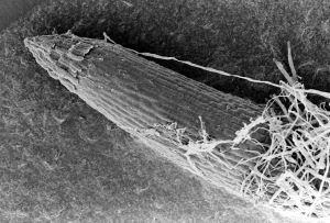 Fungal hyphae (small white strands) surround a root tip.