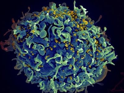 Microscopy image depicting a cell being infected by HIV. 