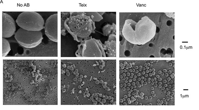 SEM image of bacteria treated with teixobactin.