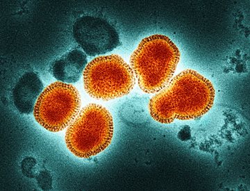 A microscopic view of Influenza A virus.