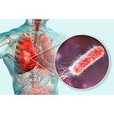 3D illustration of bacteria-caused lung infection.