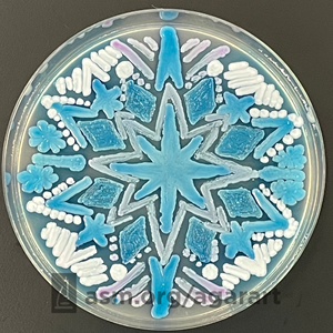 "The birth of a star" Agar Art image