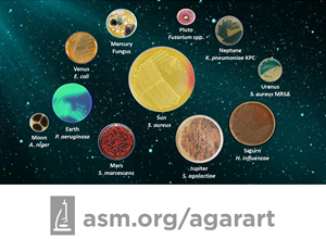 "Space colonization" Agar Art image