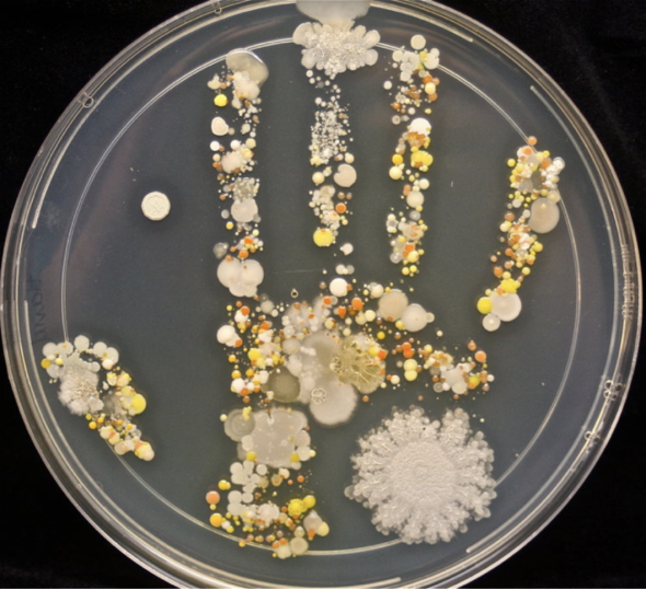 Microbes from a child's hand after playing outside.