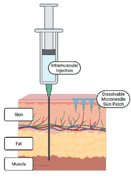 Illustration of difference between intramuscular vaccines, which must travel through the skin, fat and into the muscle, and microneedles, which deliver vaccine to the skin. 