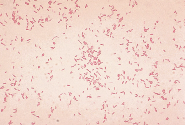 Gram stain of Aeromonas, displaying short, plump, Gram-negative rods.