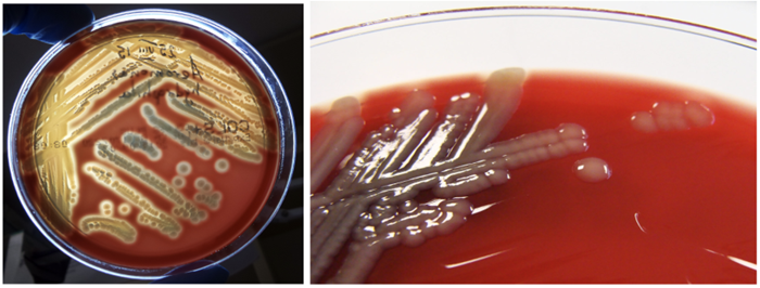 Colonies of Aeromonas hydrophila and a close-up of Aeromonas hydrophila colonies