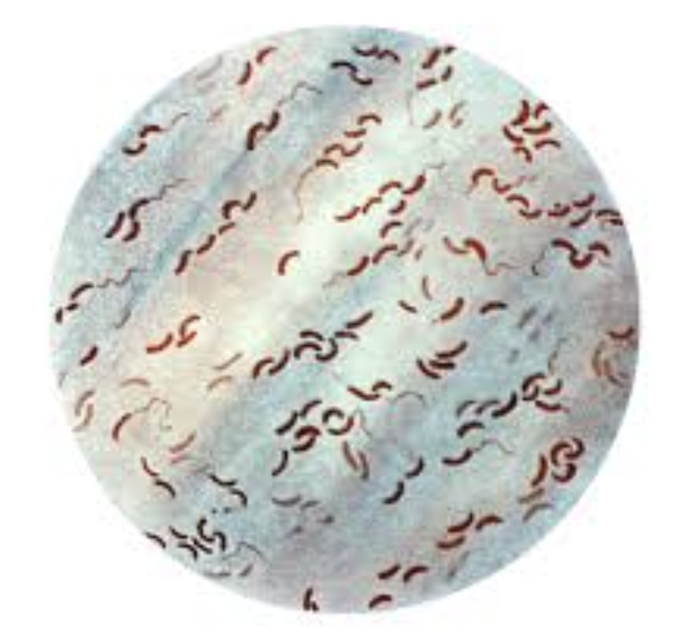 Gram stain of Vibrio displaying curved, Gram-negative rods.