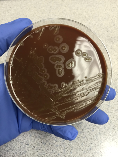 Eikenella corrodens colonies on chocolate agar.