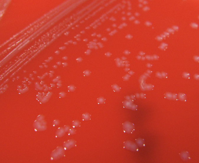 Pasteurella multocida colonies on blood agar.