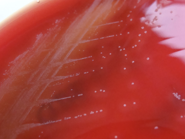 Colonies of S. anginosus growing on blood agar.