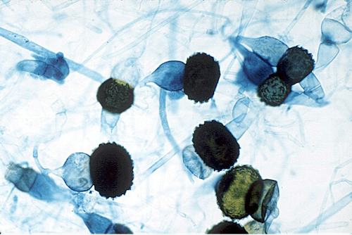 Rhizopus spores, from the genus of fungi used in the production of soy ferments.